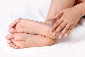 treatment of cream against fungus of the skin of the feet